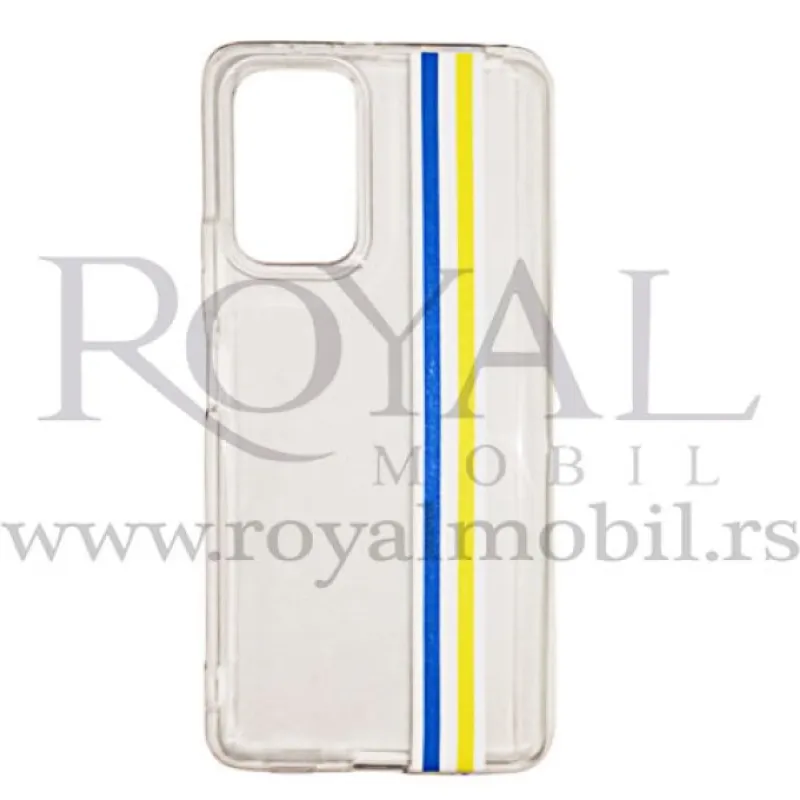 Silikonska futrola CLEAR CLEIN za Xiaomi Redmi Note 10 Pro / Redmi Note 10 Pro Max plavo-zuta